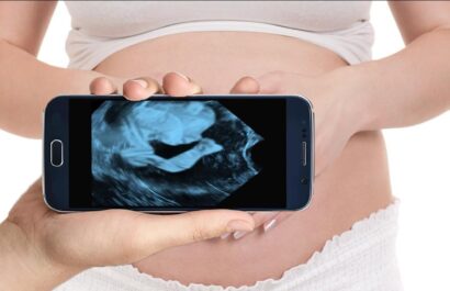 Aplicaciones de ultrasonido durante el embarazo: guía